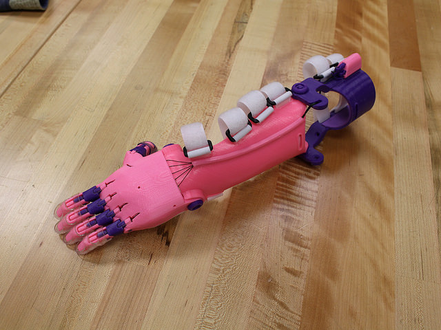 pink and purple prosthetic arm and hand